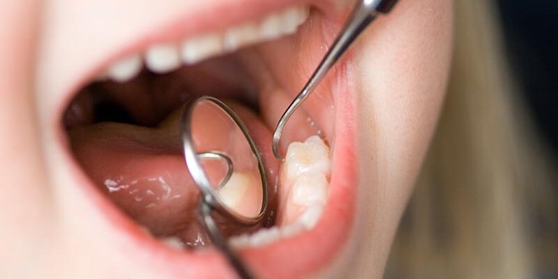 Zahnärzte können seltene Erkrankungen aufspüren